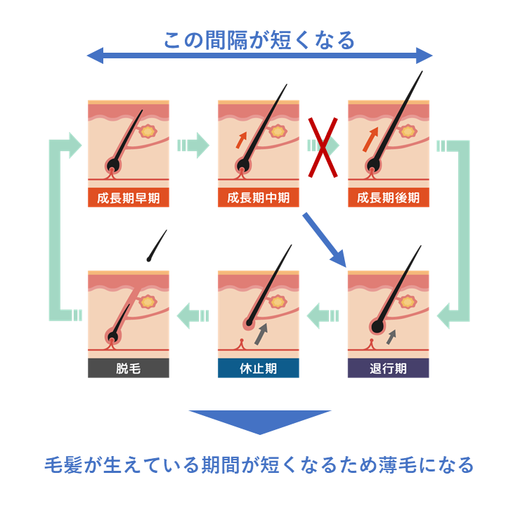 フォリックスFRクラシック